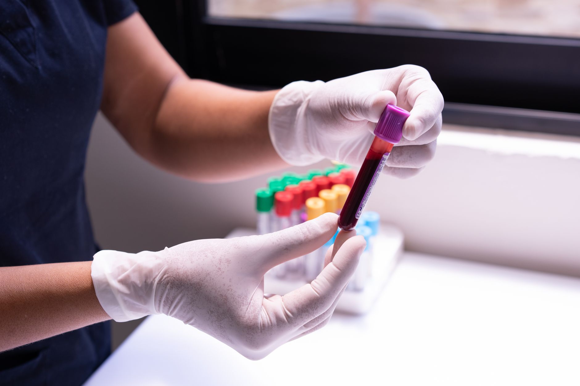 a person holding vacutainer