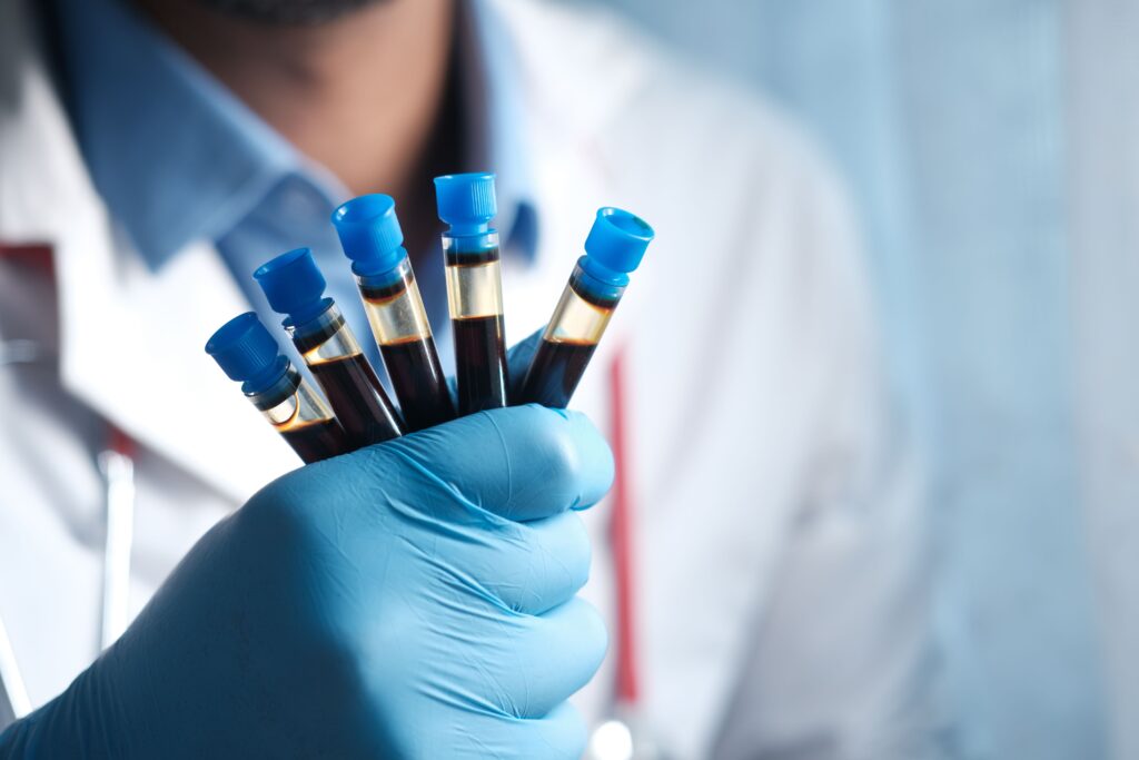 pexels-photo-8600447-8600447 Close-up of a medical technician holding several blood samples in test tubes, highlighting healthcare.